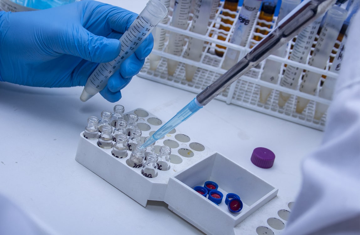 Milan Testing Laboratory renueva acreditación ISO/IEC Standard 17025:2017 incluyendo análisis de perfil de aminoácidos
